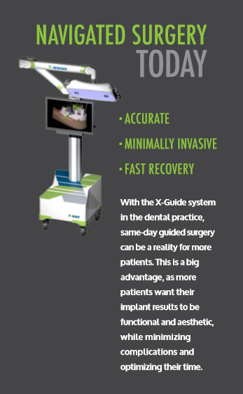 X-Guide® surgical system